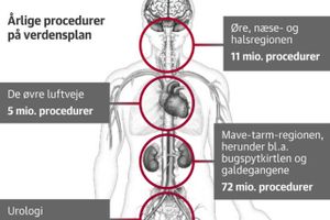 Medicoselskabet Ambu vil revolutionere markedet for endoskoper og satser benhårdt på et stort indtog på nye og enorme markeder. Virkeligheden er dog, at udfordringerne står i kø.