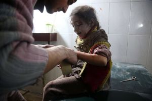 Et syrisk barn modtager behandling på et midlertidigt hospital i den østlige del af Ghouta. Foto: ABDULMONAM EASSA