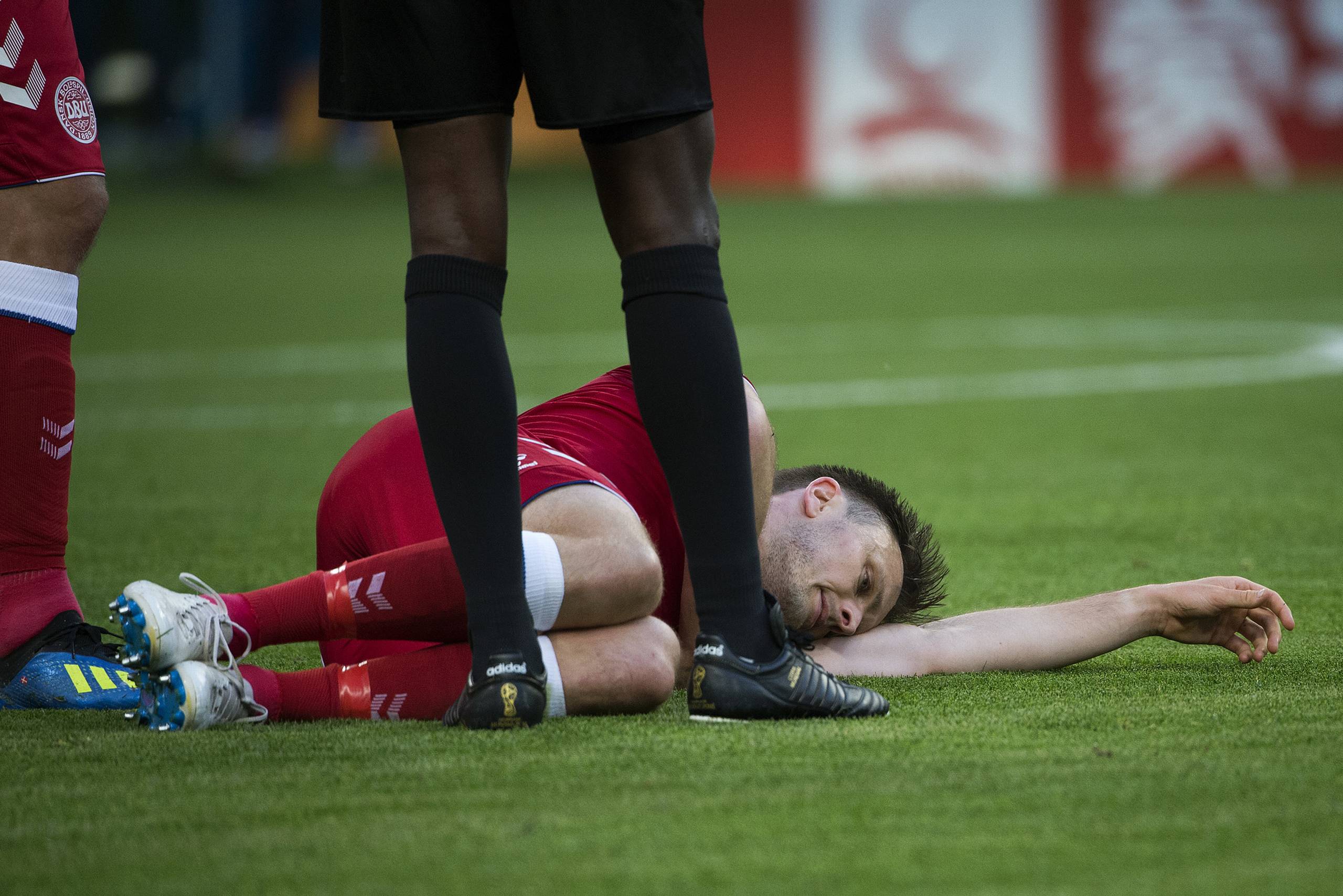 William Kvist blev skadet under kampen mellem Danmark og Peru. Foto: Liselotte Sabroe/Ritzau Scanpix