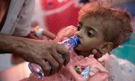 En far giver sin stærkt underernærede datter lidt vand på et hospital i Hodeida i Yemen. Borgerkrigen i landet udgør ifølge FN verdens største humanitære krise. Men parterne har ikke fulgt opfordringen fra FN's generalsekretær til at holde våbenhvile i skyggen af coronavirussen. Arkivfoto: Hani Mohammed/AP