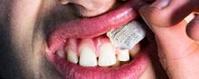 - Når snus ligger op ad tandkødet i længere tid, ætser det overfladen. Tandkødet danner en hvidlig barriere, og tandkødet begynder at trække sig. I de helt svære tilfælde kan vi se, at knoglen omkring tænderne forsvinder, advarer tandplejer Eva Christiansen. Arkivfoto: Melissa Kühn Hjerrild/Polfoto