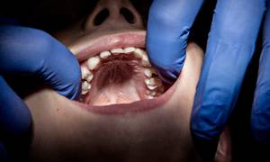 Tandlægen.dk har andele i 51 af landets tandlægeklinikker, som ifølge selskabets egne tal behandler flere end en kvart million danskere. Foto: Katinka Hustad