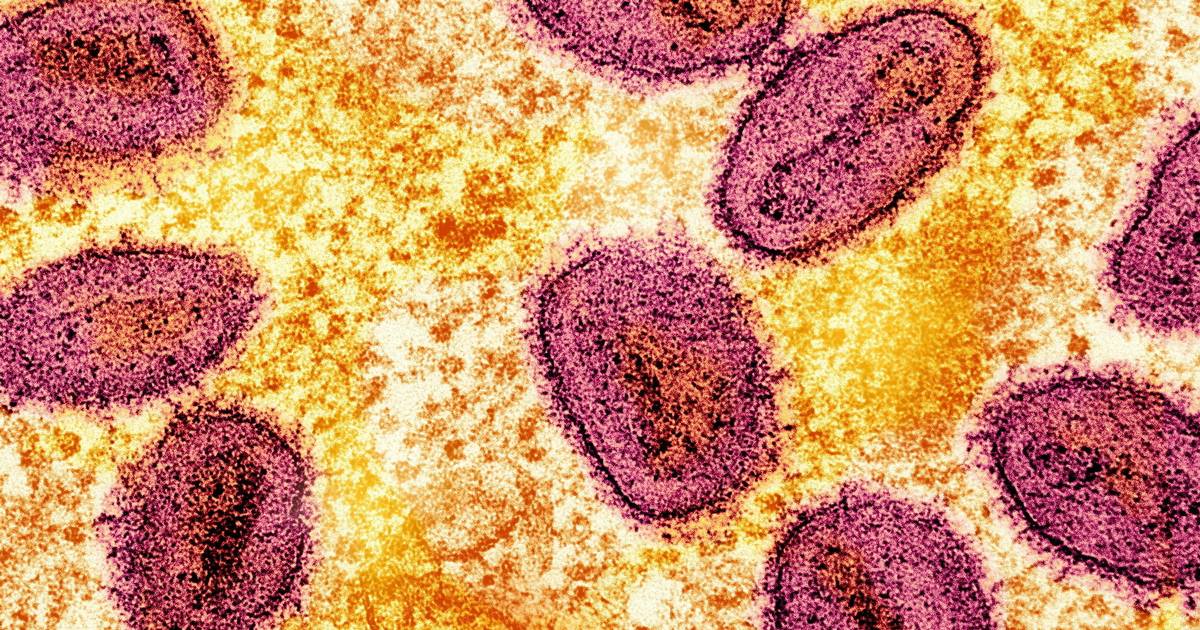 Første tilfælde af ny mpox-variant er opdaget i Tyskland - Jyllands-Posten