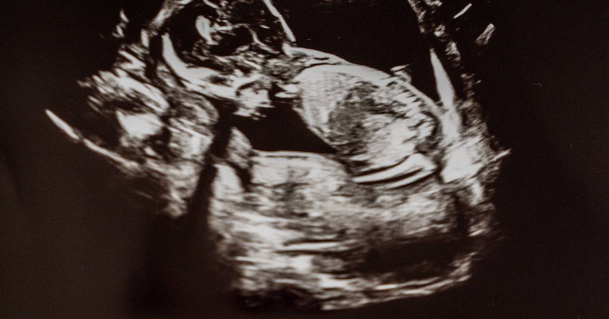 Ny aftale giver dobbelt så mange fertilitetsforsøg til barn nummer to