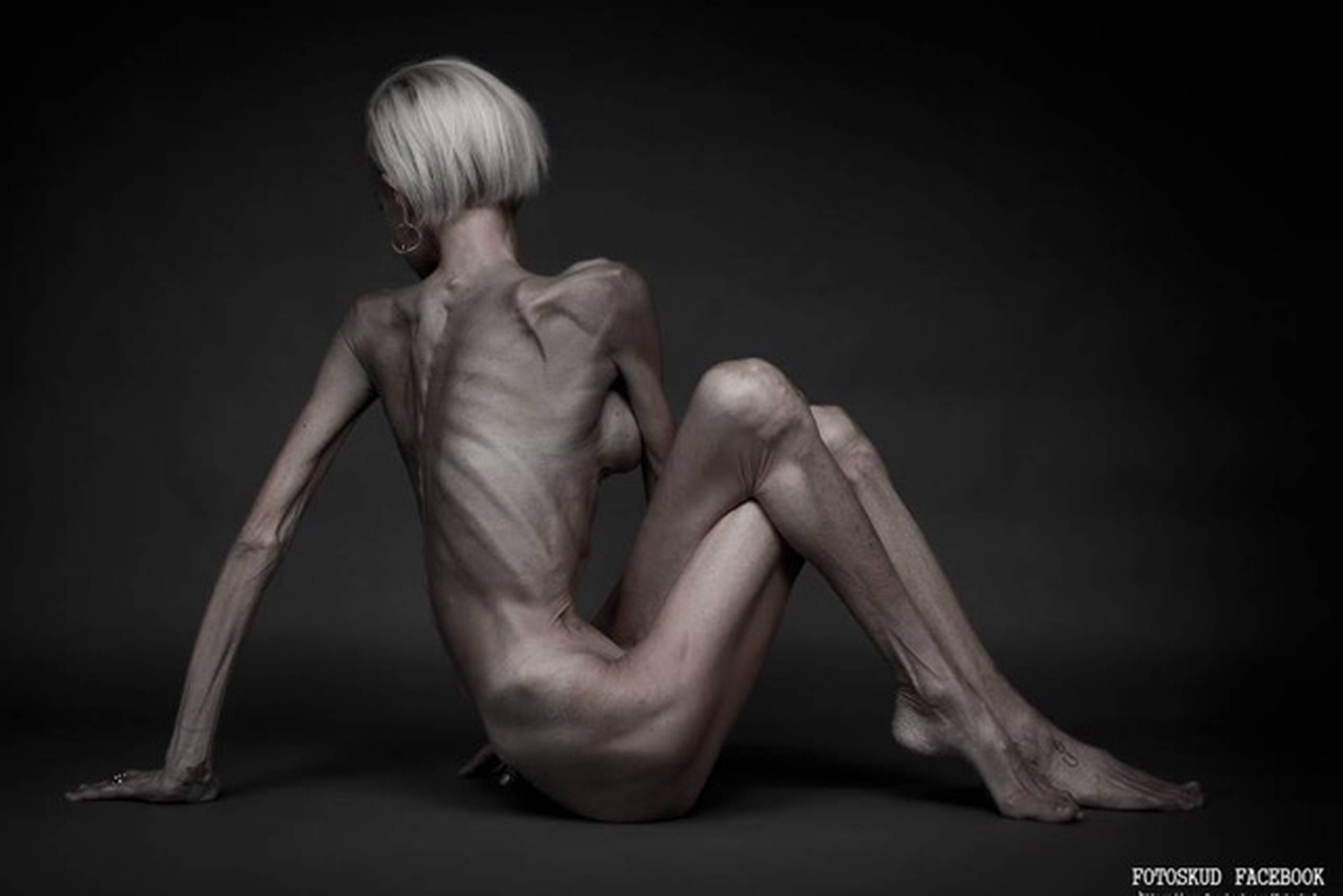 Signe Grønnebæk blev chokeret, da hun så billederne af sig selv. Foto: John Andersen/ Fotoskud