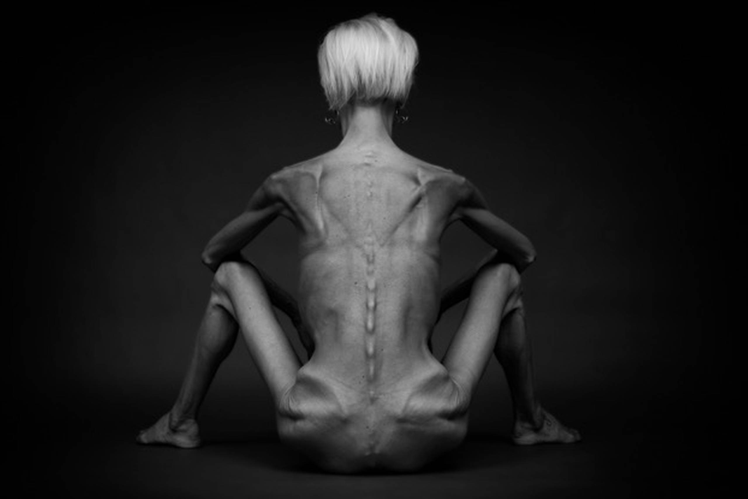 Signe Grønnebæk.  Foto: Johnny Andersen/Fotoskud