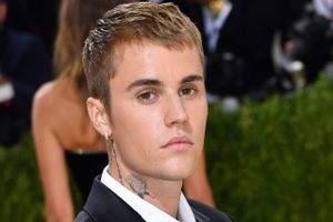 Justin Bieber fortalte fredag sine fans, at han lider af en sjælden sygdom. Han spiller på Smukfest i starten af august, men har allerede aflyst to koncerter.